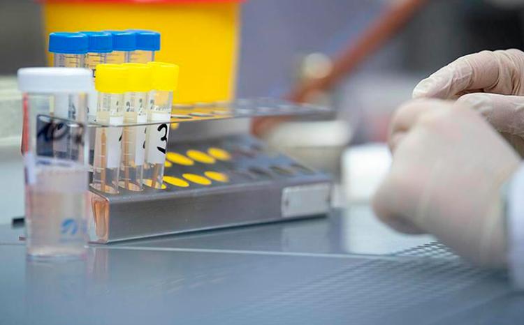 В Азербайджан доставлены тест-наборы на оспу обезьян 