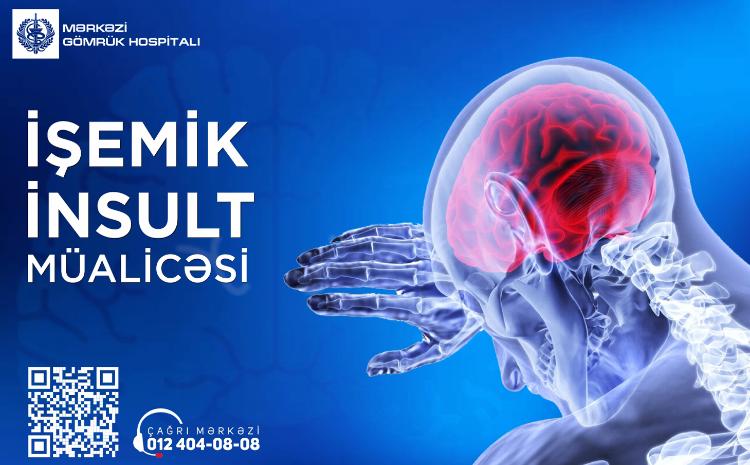 В Центральном Таможенном Госпитале успешно проводится лечение ишемического инсульта 