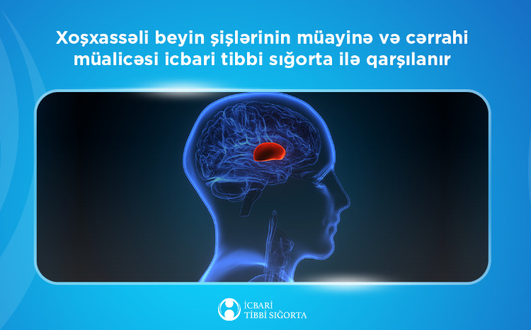Xoşxassəli beyin şişlərinin müayinə və cərrahi müalicəsi icbari tibbi sığorta ilə qarşılanır 
