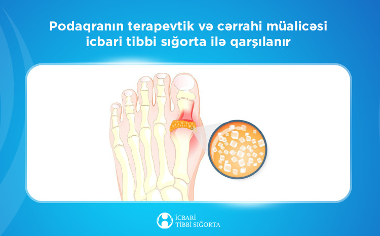 Podaqranın müayinə və stasionar müalicəsi icbari tibbi sığorta ilə qarşılanır 