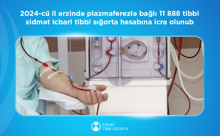 Plazmaferez - qanın zərərli maddələrdən təmizlənməsi icbari tibbi sığorta təminatına daxildir 