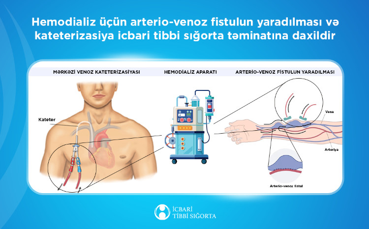 Xroniki böyrək çatışmazlığı olan vətəndaşlara icbari tibbi sığorta hesabına 1480-dən çox ilkin hemodializ xidməti göstərilib 